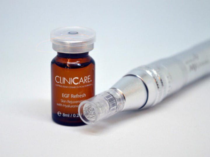 Microneedling 60 min 2095:-